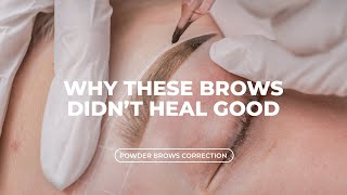 These Brows Didn’t Heal Very Well - Here Is Why