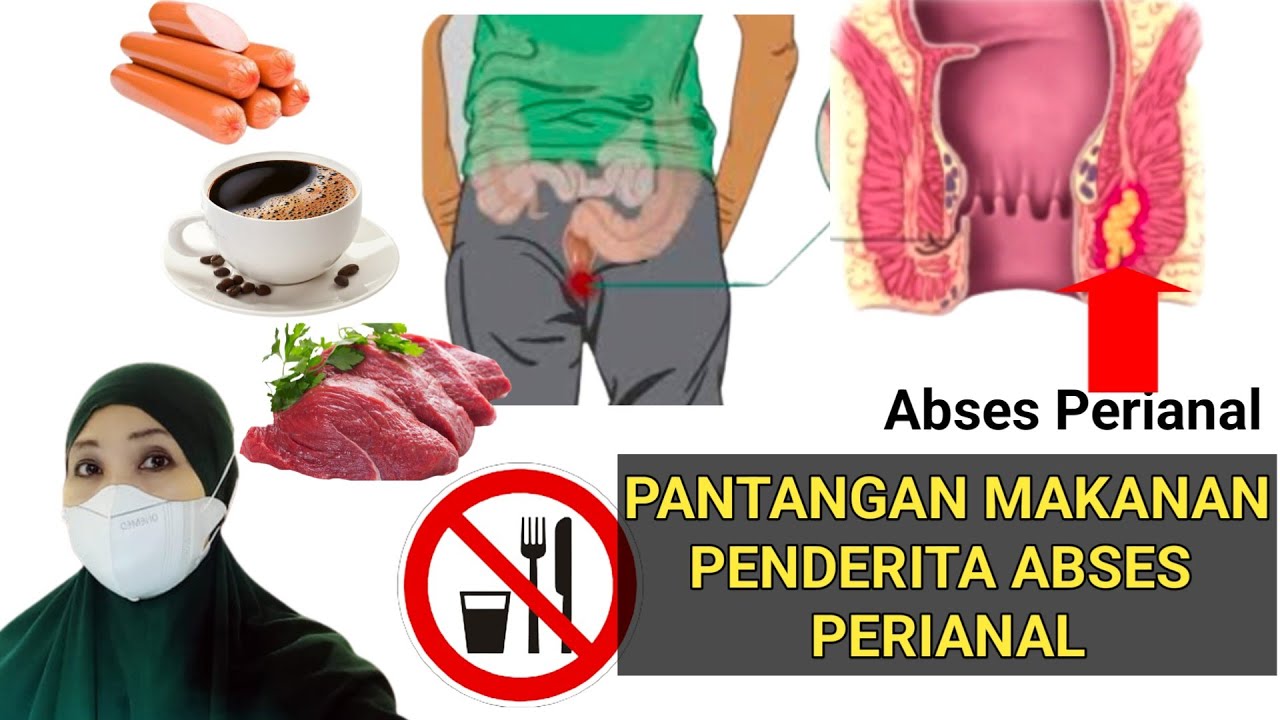 MAKANAN PANTANGAN abses perianal - HINDARI jenis makanan ini 