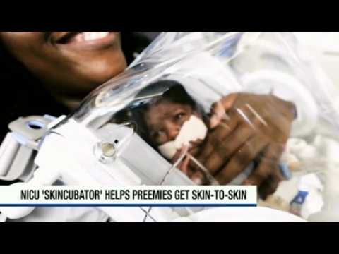 Houston hospital first in U.S. to evaluate “Skincubator” to expand NICU skin-to-skin