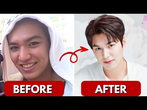 Korean Actors Plastic Surgery | Cha Eun Woo | Lee Junho | Song Joong ki | Lee Min Ho