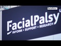 Facial Palsy DVD 2 - Management of Synkinesis - Introduction