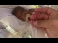 Tiny miracle baby born 18 weeks early is home for the holidays