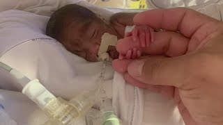Tiny miracle: Baby born 18 weeks early is home for the holidays