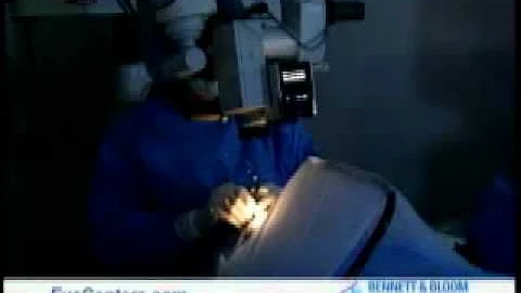 Dr. Donald Bennett Discusses What's New in Catarac...