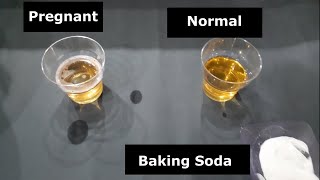 Baking Soda Pregnancy Test : A 2.000-year-old ancient test. !