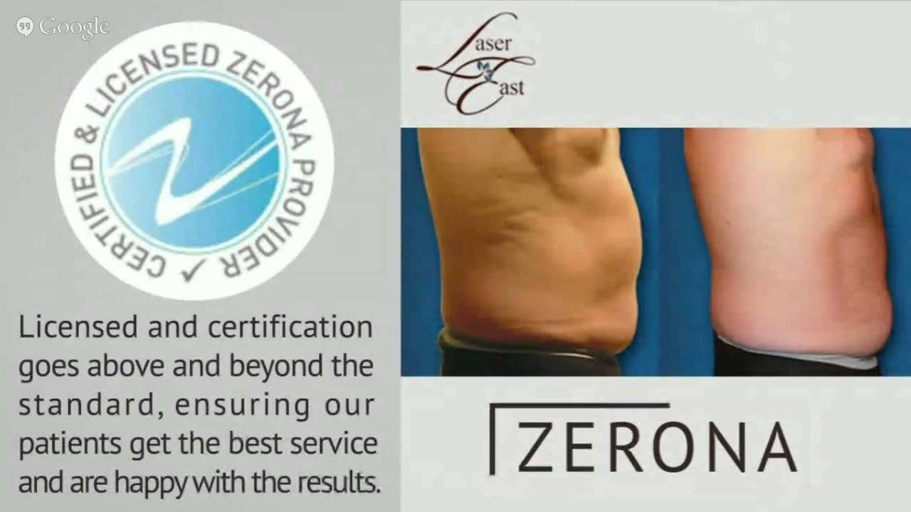 How does the Zerona laser treatment work and what are the side effects?