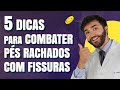 5 Dicas para combater pés Rachados com Fissuras | Dr Lucas Fustinoni - Médico - CRMPR: 30155