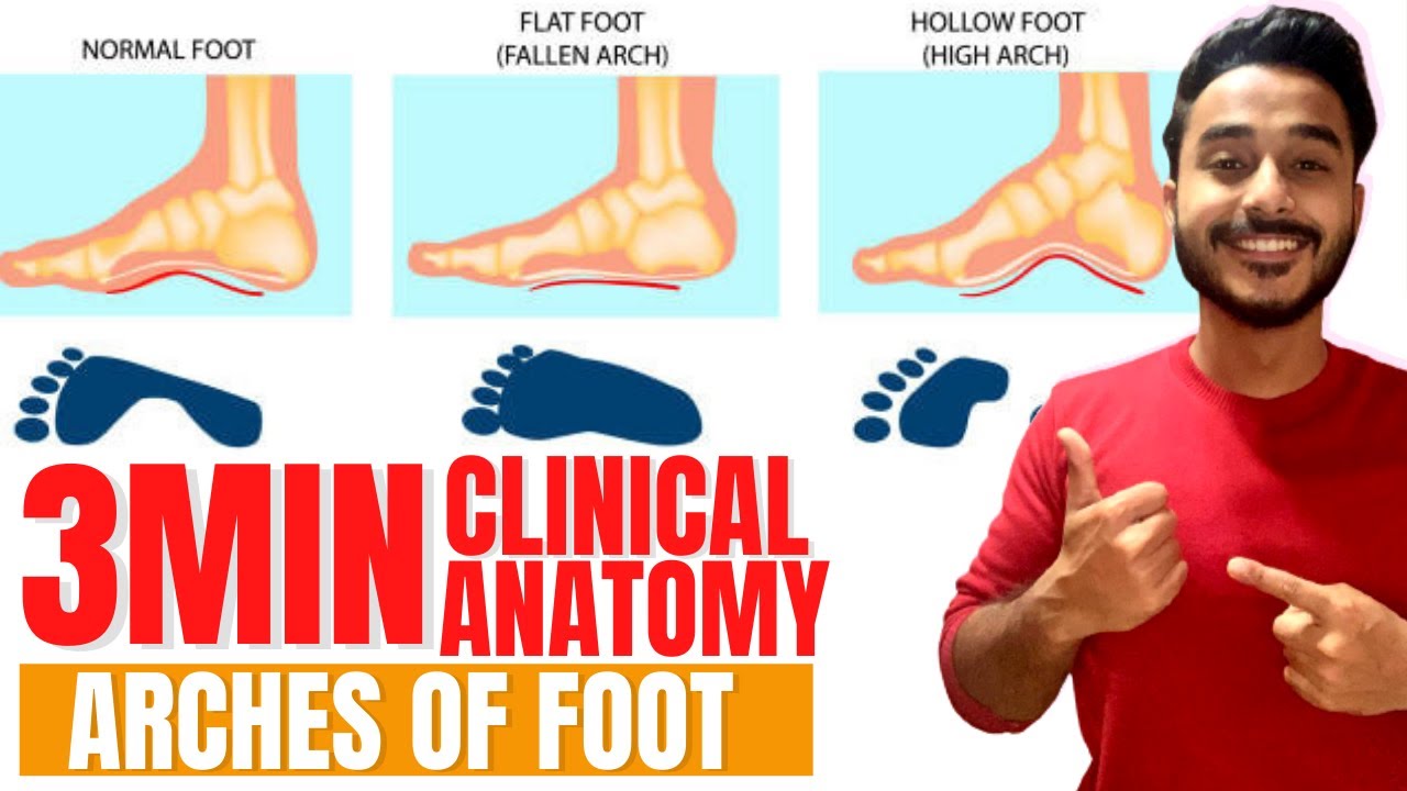 flat foot clinical anatomy of arches of foot clinical anatomy | lower limb clinical anatomy