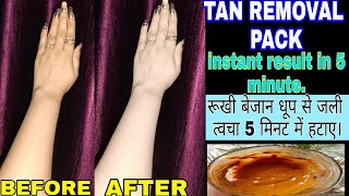 How To Remove Sun Tan | Sun Tan Removal Home Remedy | Suntan Removal Pack | Sun Tan