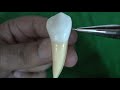 Morphology of Mandibular First Premolar