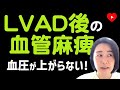 【重症心不全】LVAD後の血管麻痺で血圧が上がらない！[Vasoplegia]