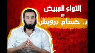 إلتواء المبيض  -  د. حسام  درويش