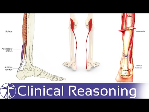 Achilles Tendinopathy Differential Diagnosis