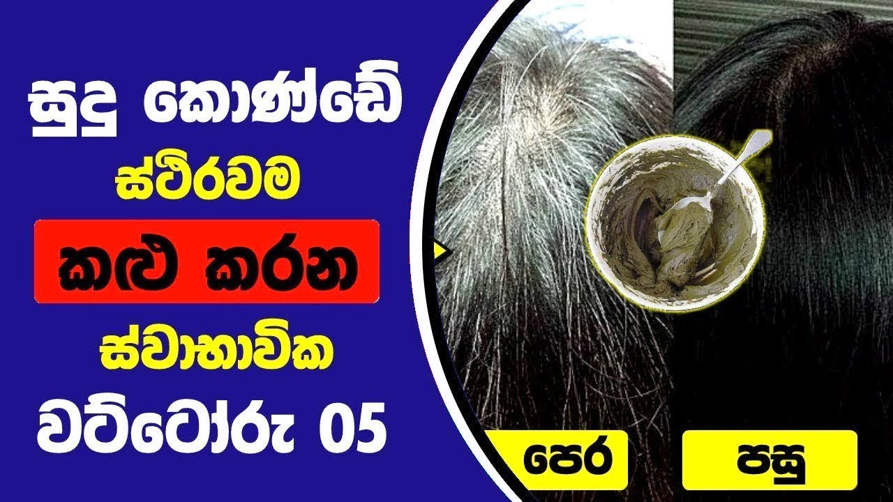  5 5 Home Remedies To