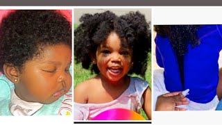 HOW TO GROW BABY’S HAIR FAST| GROW BALD SPOTS FAST