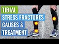 Tibial Stress Fractures   Treatment  Healing Times