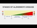 Diagnosing alzheimers disease