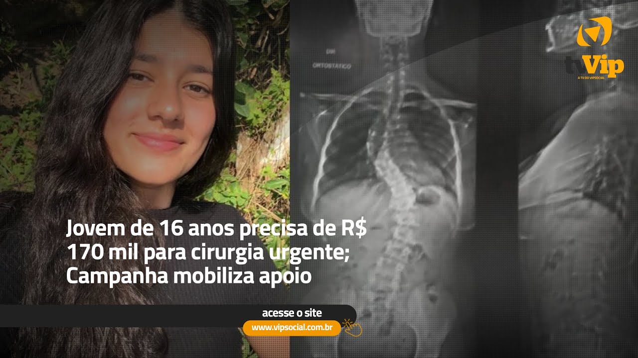 Menina de 12 anos com escoliose severa ganha vaquinha para pagar