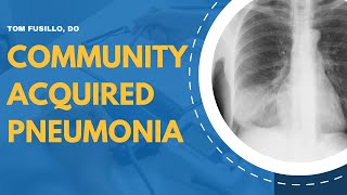 Community Acquired Pneumonia | Bacterial vs Viral, Diagnosis, and Choosing Antibiotics for Treatment