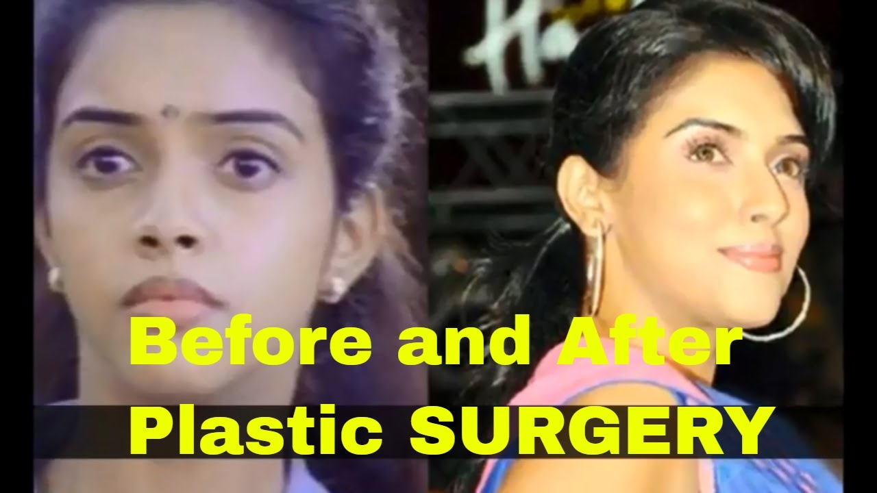 South Indian Actress Before And After Plastic Surgery Rare Photos Actresses Plastic Surgery