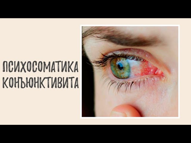 Психосоматика конъюнктивита - психологические причины конъюнктивита