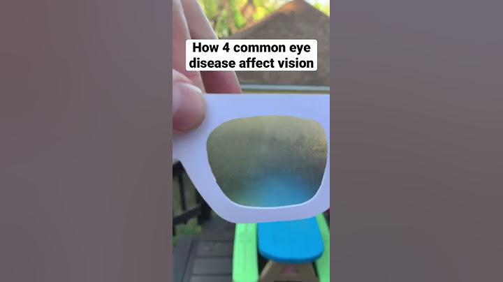 Eye Diseases Vision Simulation