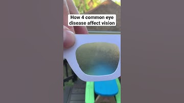 Eye Diseases Vision Simulation
