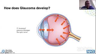 Digital Glaucoma Support Group: Glaucoma for the newly diagnosed