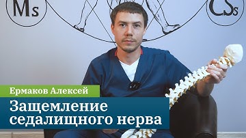 Защемление седалищного нерва. Причины, симптомы и лечение. Кинезиолог Ермаков Алексей