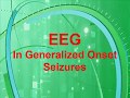 EEG in generalized onset seizures