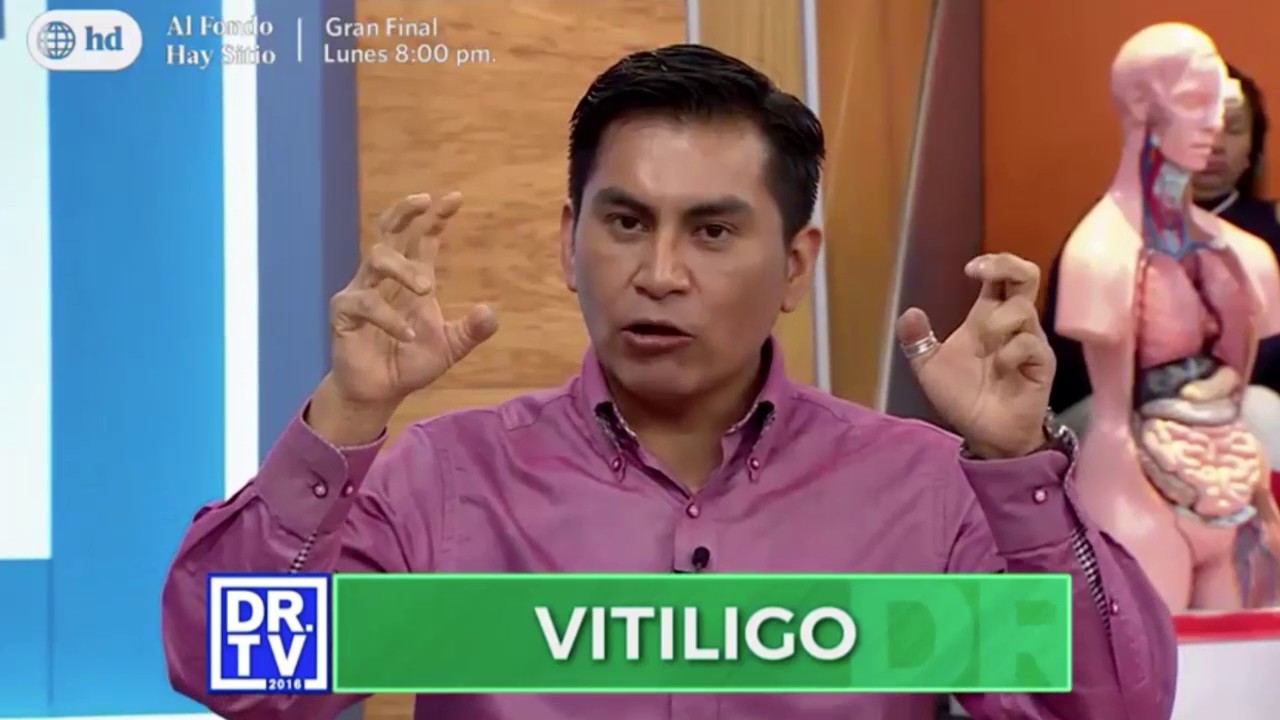 DR.TV – Vitiligo perú vs chile