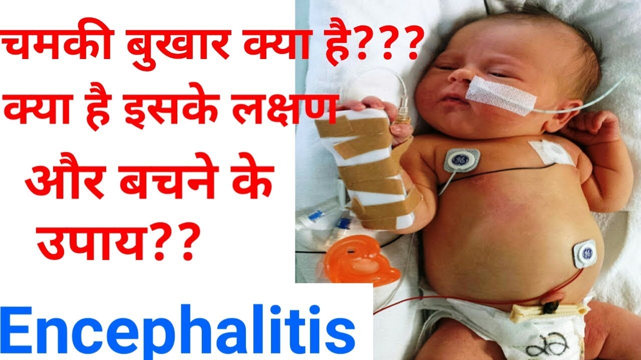 Causes, Symptoms and Treatment Acute Encephalitis Syndrome Or 'Chamki Bukhar'|| By Sonam's Lifestyle