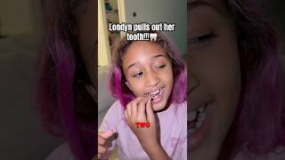Londyn loses another TOOTH!! #shorts
