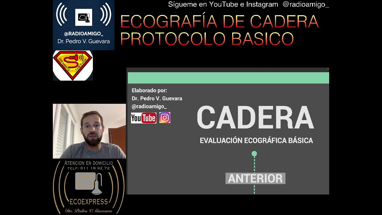 ULTRASONIDO DE CADERA - PROTOCOLO BÁSICO. INFOGRÁFICO (ECOGRAFIA)