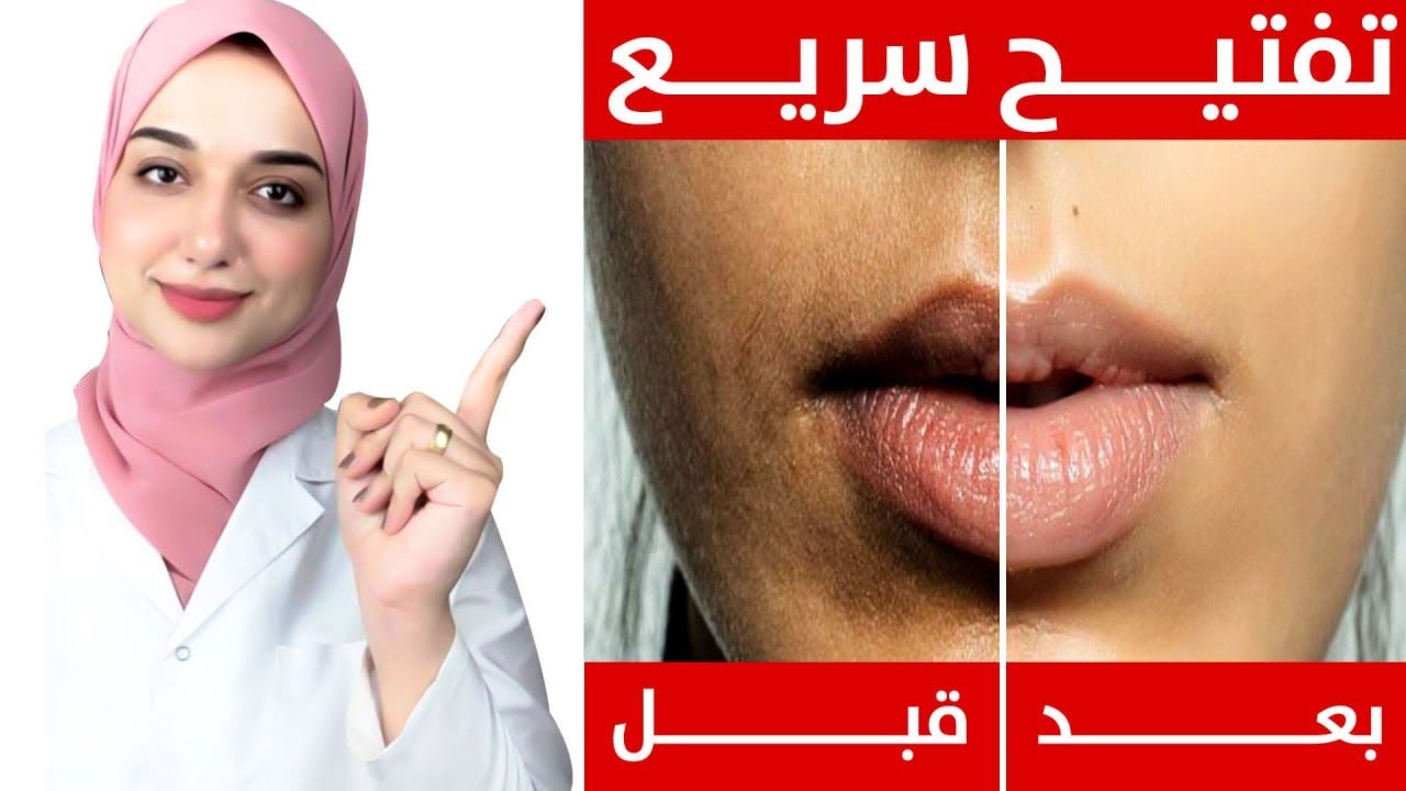 في دقايق وصفة لتفتيح اسمرار حول الفم / تفتيح وتوحيد لون البشرة بسرعة
