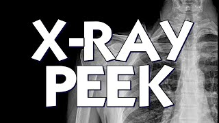 Thumbnail for Magic Review - X-Ray Peek by Michel