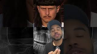 Corpo de Oliver Tree foi reconhecido
