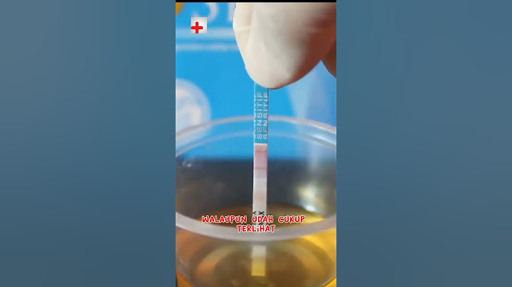 INILAH HASIL TESPEK POSITIF HAMIL