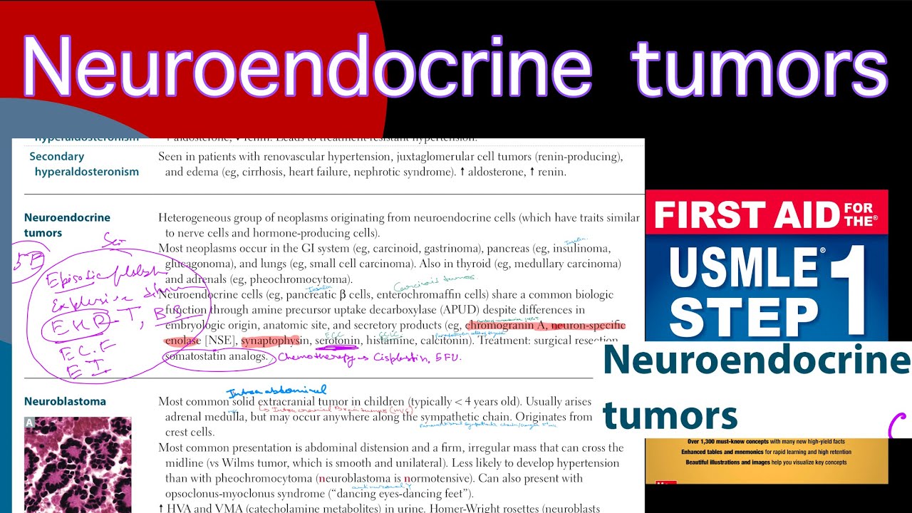 Neuroendocrine tumors in Hindi/Urdu by first aid for USMLE step 1 - YouTube
