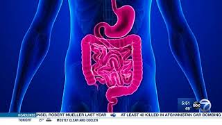 Researchers working to find cause of celiac disease