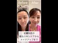 ある皮膚科医の最近のモーニングスキンケアルーティン #shorts