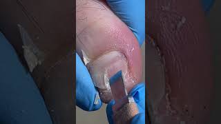 Satisfying pedicure video! #toenails #pedicure #satisfying