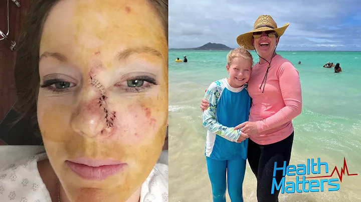 A Young Mom's Skin Cancer Warning | Health Matters | KSPS PBS