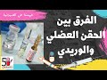 حقنه وريد أو عضل ازاي تفرق بينهم
