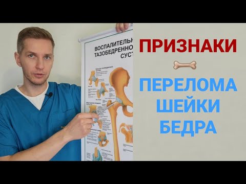 ПРИЗНАКИ ПЕРЕЛОМА ШЕЙКИ БЕДРА.