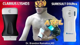 D3 Ultra vs Clarius L15: Fast ATFL Imaging Test
