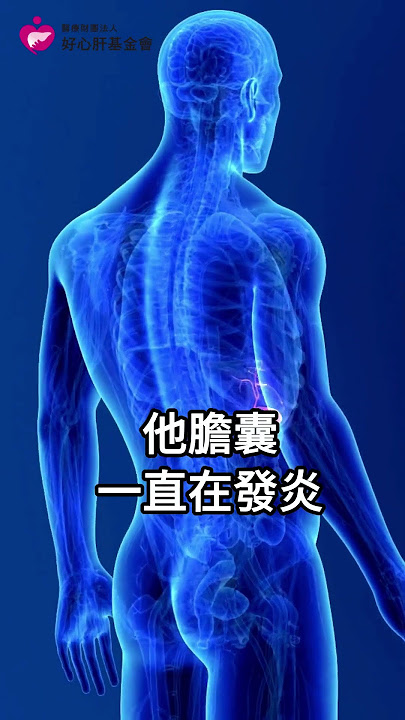 【發現有膽結石，該開刀嗎？】好心肝肝膽腸胃科林姿伶醫師認為，超過三公分或是開始作怪就要注意了！ ＃膽結石 ＃膽囊 ＃膽囊癌