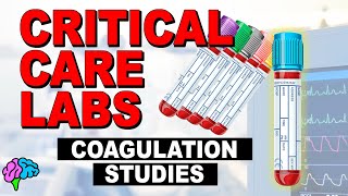 Coags - Coagulation Studies - Critical Care Labs