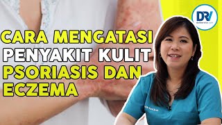 Cara atasi Eksim (Eczema) dan Psoriasis