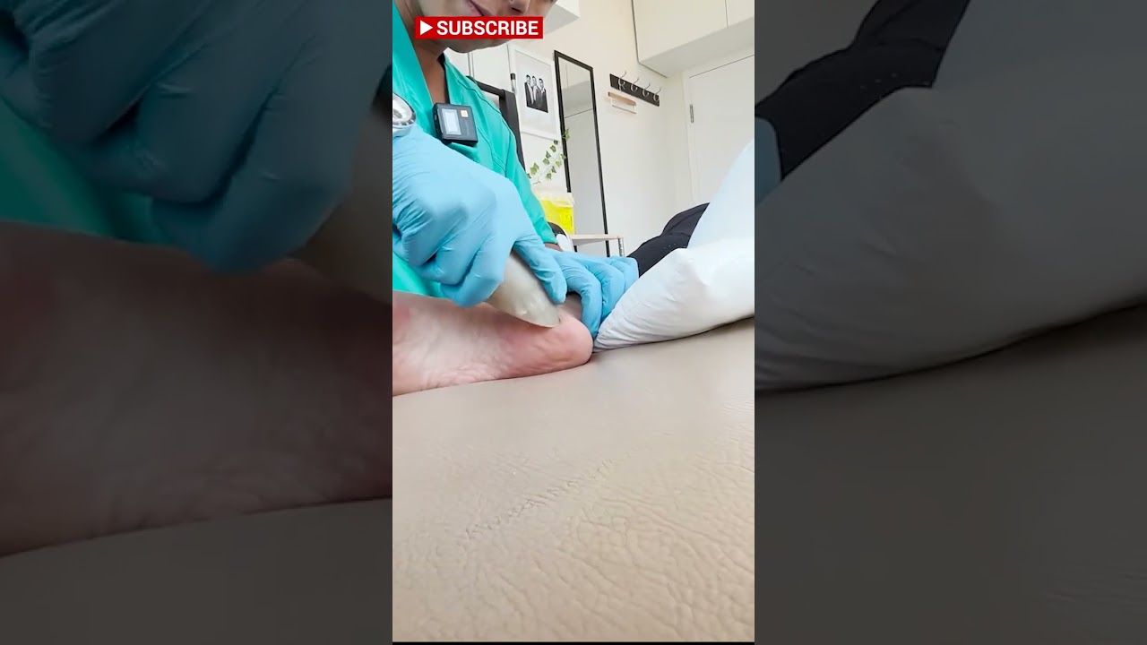 ASMR: Gua Sha For Plantarfasciitis